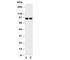MALT1 Paracaspase antibody, R31020, NSJ Bioreagents, Western Blot image 