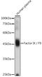 Coagulation Factor IX antibody, GTX55612, GeneTex, Western Blot image 