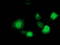 Microtubule-associated protein RP/EB family member 2 antibody, TA502859, Origene, Immunofluorescence image 