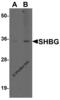 Sex Hormone Binding Globulin antibody, 7935, ProSci Inc, Western Blot image 