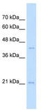 MAF BZIP Transcription Factor K antibody, TA342419, Origene, Western Blot image 