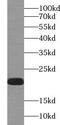 Vesicle-associated membrane protein 7 antibody, FNab09364, FineTest, Western Blot image 