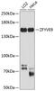 Zinc Finger FYVE-Type Containing 9 antibody, GTX64921, GeneTex, Western Blot image 