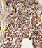 TPIS antibody, LS-C160139, Lifespan Biosciences, Immunohistochemistry frozen image 