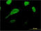 GLE1 RNA Export Mediator antibody, LS-C197306, Lifespan Biosciences, Immunofluorescence image 