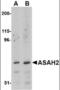 N-Acylsphingosine Amidohydrolase 2 antibody, orb89823, Biorbyt, Western Blot image 