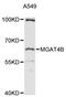 Alpha-1,3-Mannosyl-Glycoprotein 4-Beta-N-Acetylglucosaminyltransferase B antibody, LS-C747880, Lifespan Biosciences, Western Blot image 
