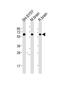 Dihydropyrimidinase Like 5 antibody, M08644-2, Boster Biological Technology, Western Blot image 