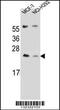 Lin-7 Homolog C, Crumbs Cell Polarity Complex Component antibody, 56-659, ProSci, Western Blot image 