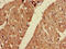 Fatty Acid Desaturase 1 antibody, orb48196, Biorbyt, Immunohistochemistry paraffin image 