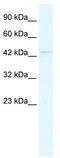 GA Binding Protein Transcription Factor Subunit Beta 1 antibody, TA330138, Origene, Western Blot image 
