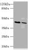 ATP-sensitive inward rectifier potassium channel 1 antibody, A53694-100, Epigentek, Western Blot image 