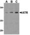 ANTXR Cell Adhesion Molecule 1 antibody, A01563, Boster Biological Technology, Western Blot image 