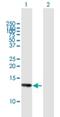 HLA class I histocompatibility antigen protein P5 antibody, H00010866-B01P, Novus Biologicals, Western Blot image 