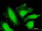 FANCD2 And FANCI Associated Nuclease 1 antibody, H00022909-B01P, Novus Biologicals, Immunofluorescence image 