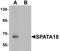 Spermatogenesis Associated 18 antibody, LS-B9604, Lifespan Biosciences, Western Blot image 