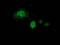 Potassium Channel Tetramerization Domain Containing 14 antibody, MA5-25488, Invitrogen Antibodies, Immunocytochemistry image 