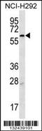 Membrane Bound Transcription Factor Peptidase, Site 2 antibody, 56-769, ProSci, Western Blot image 
