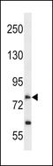Solute Carrier Family 28 Member 2 antibody, LS-C161205, Lifespan Biosciences, Western Blot image 