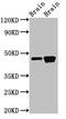 GSP antibody, CSB-PA352389LA01HU, Cusabio, Western Blot image 