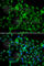 Probable N-acetyltransferase 8B antibody, A7203, ABclonal Technology, Immunofluorescence image 