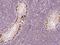 SSX Family Member 2B antibody, 204880-T08, Sino Biological, Immunohistochemistry paraffin image 