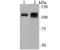 ATPase Sarcoplasmic/Endoplasmic Reticulum Ca2+ Transporting 1 antibody, NBP2-76912, Novus Biologicals, Western Blot image 