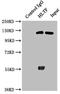 Helicase Like Transcription Factor antibody, LS-C673583, Lifespan Biosciences, Immunoprecipitation image 