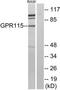 Adhesion G Protein-Coupled Receptor F4 antibody, TA316253, Origene, Western Blot image 