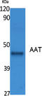 Alpha-1-antitrypsin antibody, STJ96421, St John