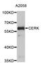 Ceramide Kinase antibody, abx126860, Abbexa, Western Blot image 