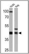 HLA class I histocompatibility antigen, A-3 alpha chain antibody, MA5-11723, Invitrogen Antibodies, Western Blot image 