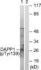 Dual adapter for phosphotyrosine and 3-phosphotyrosine and 3-phosphoinositide antibody, LS-C198872, Lifespan Biosciences, Western Blot image 