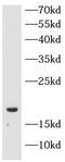 Somatostatin antibody, FNab08109, FineTest, Western Blot image 