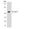 WASP Family Member 2 antibody, LS-B12509, Lifespan Biosciences, Western Blot image 