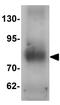Transglutaminase 7 antibody, GTX31460, GeneTex, Western Blot image 