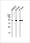 Ornithine carbamoyltransferase, mitochondrial antibody, MBS9211782, MyBioSource, Western Blot image 