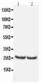 TIMP Metallopeptidase Inhibitor 4 antibody, PA5-80132, Invitrogen Antibodies, Western Blot image 
