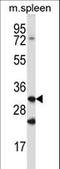 Cathepsin Q antibody, LS-C157603, Lifespan Biosciences, Western Blot image 
