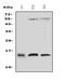 Profilin 2 antibody, PA2162, Boster Biological Technology, Western Blot image 