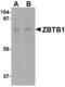 Zinc Finger And BTB Domain Containing 1 antibody, MBS150296, MyBioSource, Western Blot image 