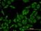 Ribosomal Protein L13 antibody, H00006137-M01, Novus Biologicals, Immunofluorescence image 