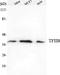 General Transcription Factor IIB antibody, STJ98560, St John