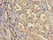 Acyl-CoA Dehydrogenase Family Member 11 antibody, LS-C672966, Lifespan Biosciences, Immunohistochemistry paraffin image 