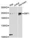 Myotubularin-related protein 5 antibody, LS-C747463, Lifespan Biosciences, Western Blot image 