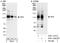 XPC Complex Subunit, DNA Damage Recognition And Repair Factor antibody, A301-122A, Bethyl Labs, Immunoprecipitation image 