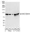 Catenin Beta 1 antibody, A302-010A, Bethyl Labs, Western Blot image 