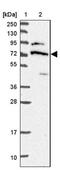 DEAD-Box Helicase 55 antibody, NBP2-47490, Novus Biologicals, Western Blot image 