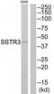 Somatostatin Receptor 3 antibody, TA314570, Origene, Western Blot image 