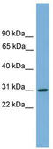 HLA class II histocompatibility antigen, DQ alpha 2 chain antibody, TA331097, Origene, Western Blot image 